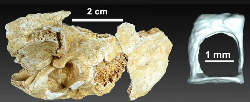 temporal bone and an auditory ossicle